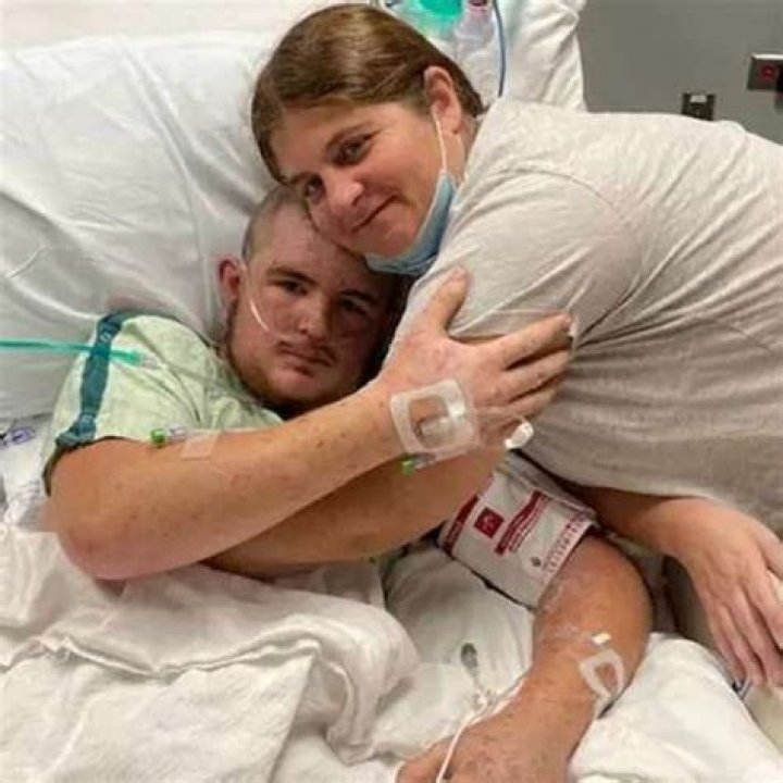 
20, Austin Bellamy, was Stung by bees 20,000 times and swallowed 30 of them 