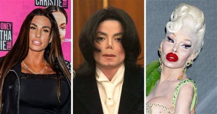Top 9 Terribly Failed Celebrity Plastic Surgeries