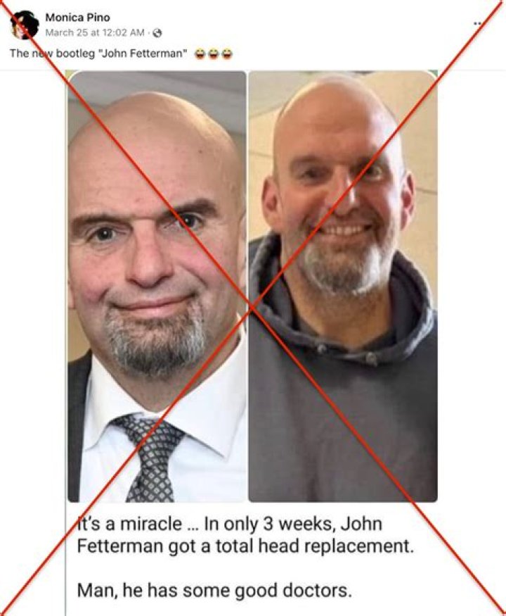 
“An ep of Attack of the Clones?”: John Fetterman body double claim goes viral as before and after pictures surface online 