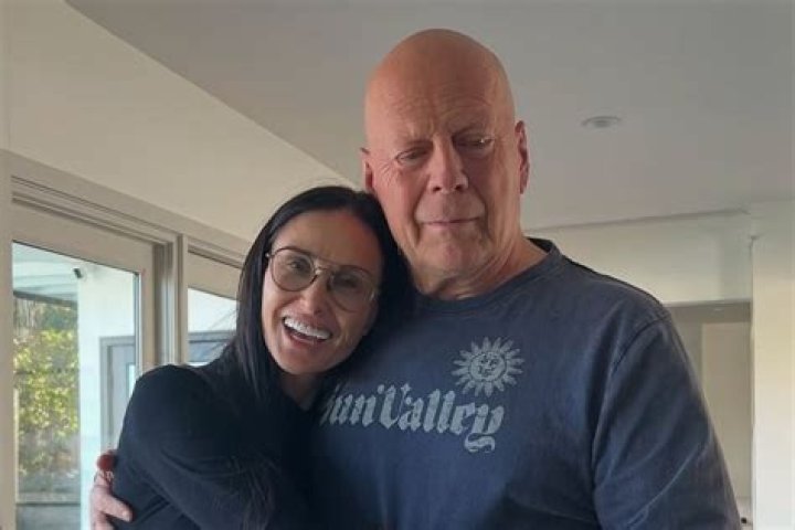 
Bruce Willis Health Updates 2024, How is Bruce Willis Doing? 