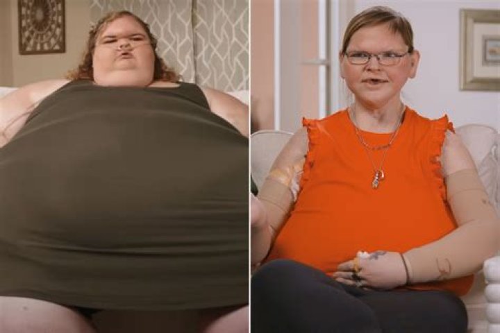 
Did Chrissie Swan Had Weight Loss Surgery? Before And After 