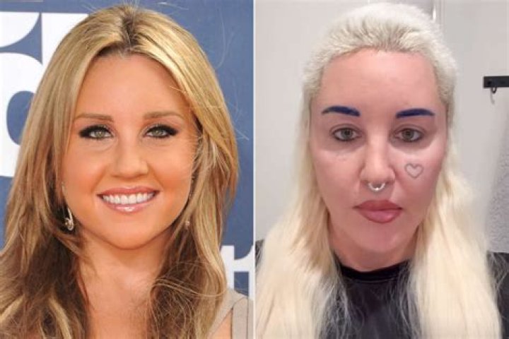 Ines Rau Plastic Surgery: Before And After Looks