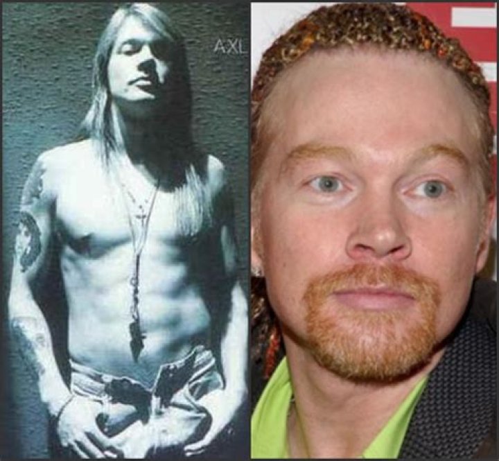 Is Bret Michaels Bald Without Wig, What Happened To His Hair? Before and After Pics