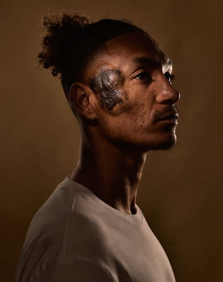 
Is Sean Clare Face Mark A Tattoo? Fans Are Concerned About The Charlton’s Player 