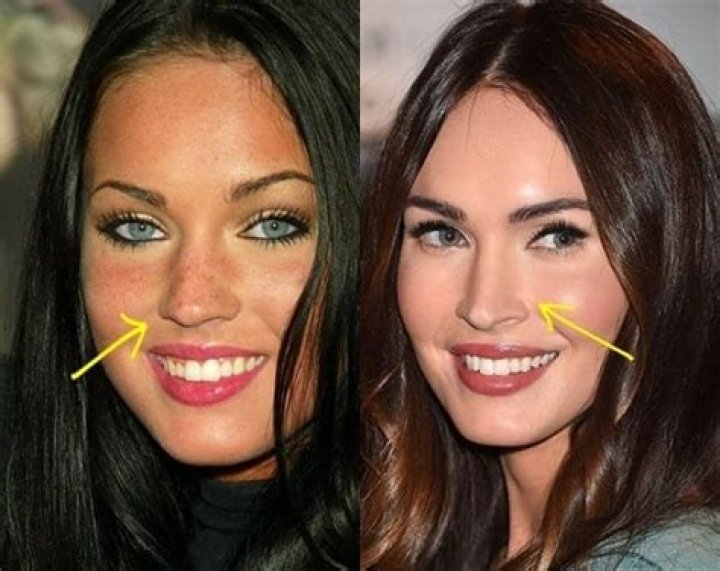 Toni Collette Teeth Before And After | What Is Wrong With Her Face