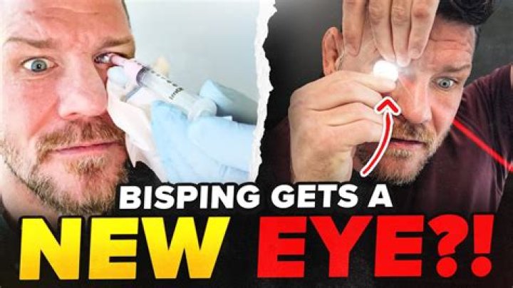 
What Happened To Michael Bisping’s Left Eye, Is He Permanently Blind? 