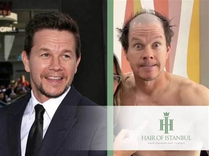 
What Is Mark Wahlberg Illness? Insane Weight Loss Transformation Before And After Pictures 