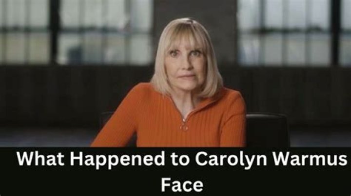 Where Is Carolyn Warmus Now? Stroke, What Happened To Face?