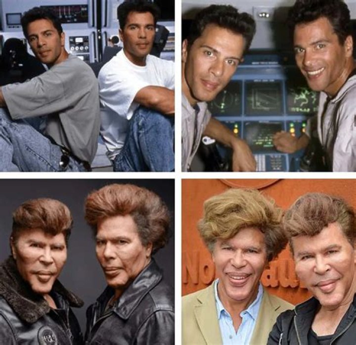 Why Did The Bogdanoff Twins Get Surgery And What Happened To Them? Before & After Pictures