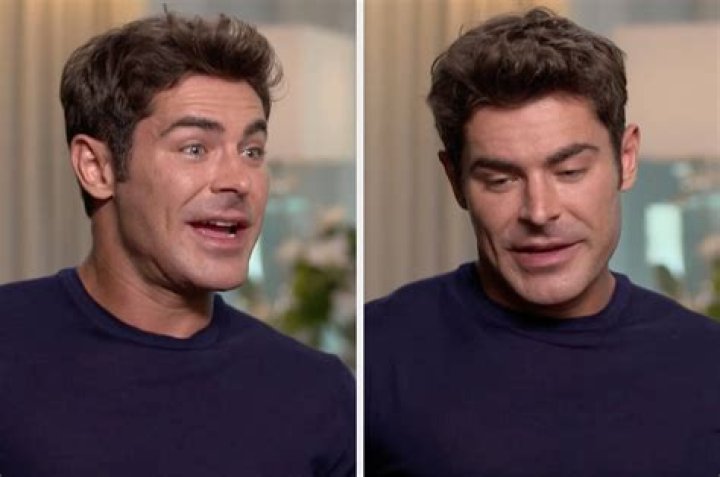 Why Does Baz Luhrmann Look So Different Now? What Has He Done To His Face?