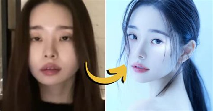 Youtuber: Song Jia Before & Plastic Surgery – Her Transformation Exposed